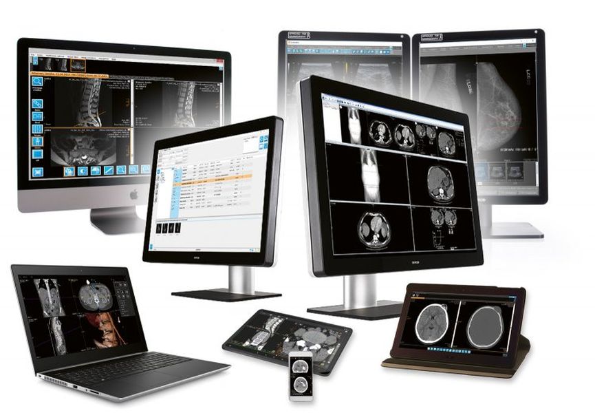 PACS Sistemi (Picture Archiving and Communication System) Nedir?
