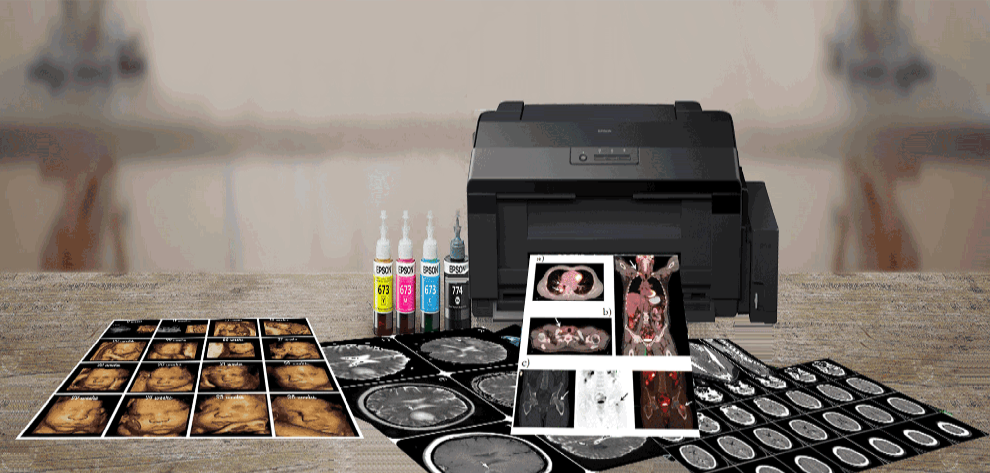 Tele Medikal Yazılım: DICOM Görüntülerini Ekonomik ve Yüksek Kaliteyle Yazdırma Çözümü